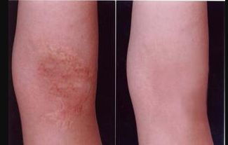 洛陽哪家醫(yī)院減重手術好？選醫(yī)院需注意哪些關鍵點？