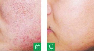 永州美辰醫(yī)療整形醫(yī)院的價(jià)格如何？收費(fèi)標(biāo)準(zhǔn)透明公開，術(shù)前注意事項(xiàng)必看！