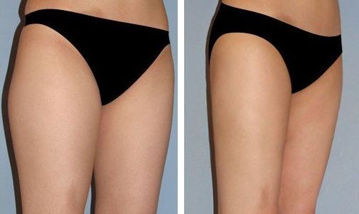 北京好的豐面部醫(yī)院哪家好？口碑最佳推薦！