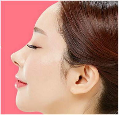 2023杭州抽脂冷凍溶脂排名榜TOP10的醫(yī)生(馮應(yīng)宏、陳鳴琦、高壽松值得信賴的選擇！)