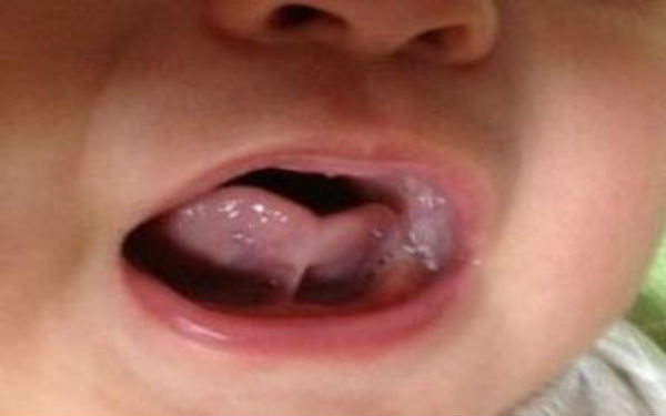 2023廣安光波祛雀斑top10強(qiáng)的醫(yī)生(朱鴷、蔣朝華、蔣朝華真實口碑橫評分享)