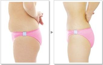 您在武漢協(xié)和醫(yī)院可以找到熱瑪吉嗎？預(yù)約技術(shù)嫻熟的醫(yī)生，口碑非常好！