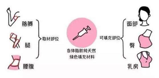 成都潘紅偉吸脂手術(shù)效果如何？專家解讀！