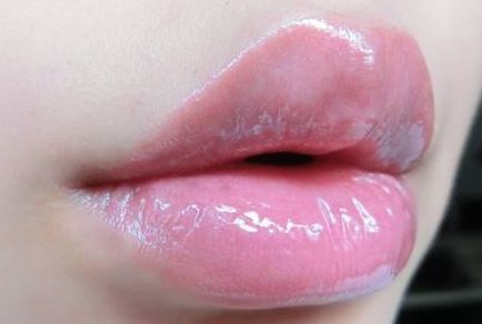 西寧哪家醫(yī)院的雙眼皮效果好？