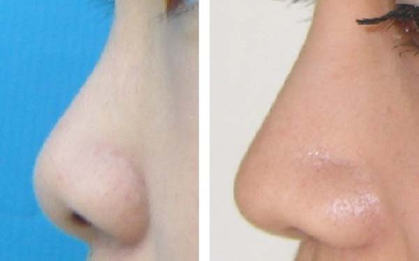 2023珠海眼上魚尾紋專家排行榜前10(李洪生、劉彤、池鉉淑醫(yī)生大咖口碑推薦)