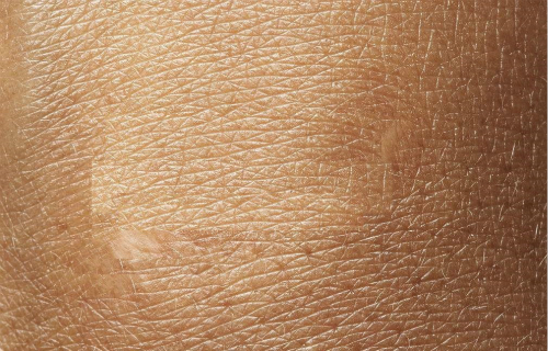 2023福州水光針祛除魚尾紋正規(guī)專家前十強(qiáng)(潘潔、蔡玉蕊、馮麗平這些醫(yī)生推薦給您)