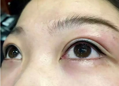 趙寅局院長(zhǎng)去哪家醫(yī)院拉皮比較好？在上海天壇普華醫(yī)院坐診