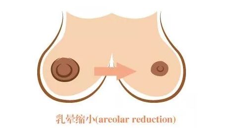 長(zhǎng)沙激光美容醫(yī)院哪家好？探尋長(zhǎng)沙地區(qū)激光美容行業(yè)領(lǐng)軍者