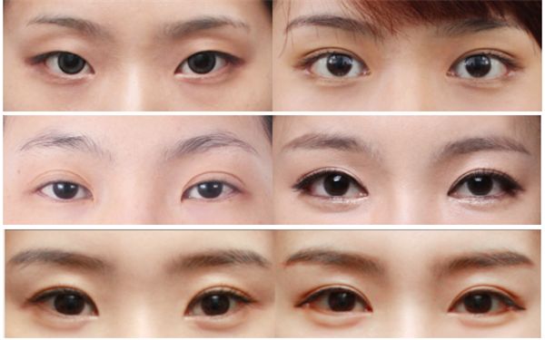 福州埋線減肥醫(yī)院哪家好？了解福州埋線減肥醫(yī)院的專業(yè)優(yōu)勢和患者評價(jià)