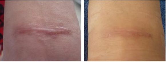 大連哪家眼科醫(yī)院提供修復外眼角最好的服務？