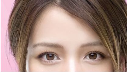 無(wú)錫哪家醫(yī)院隆鼻拆線技術(shù)好？專家為您推薦最佳選擇。