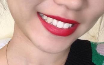 2023青島面部填充醫(yī)生前10(常書樓、白華寶、尹孝憲細(xì)數(shù)各家口碑)