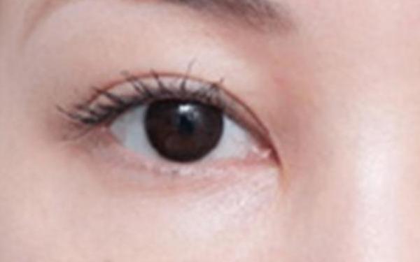 廣州哪家醫(yī)院做隆胸手術(shù)技術(shù)高？醫(yī)生資深經(jīng)驗來看詳細(xì)介紹！