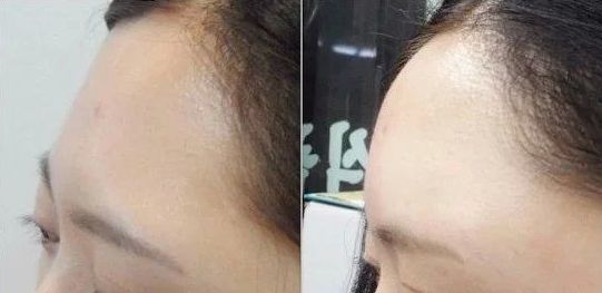 沈陽(yáng)私密整形去哪家好？專(zhuān)家推薦排行榜2023