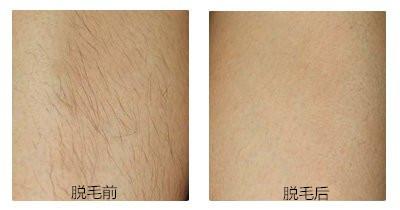 2023濰坊YS立挺鼻整專家排行前幾(王守娟、李書(shū)考、王桂芝網(wǎng)友力挺技術(shù)強(qiáng))