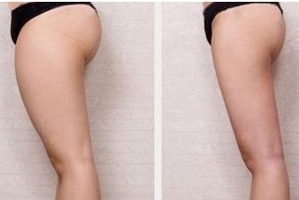 唐山哪家醫(yī)院整形科好？專家推薦，匯總唐山當(dāng)?shù)乜诒罴颜吾t(yī)院