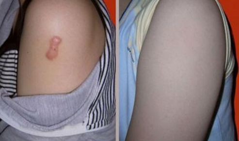 深圳隆下巴哪家醫(yī)院好？如何選擇合適的下巴整形醫(yī)院？