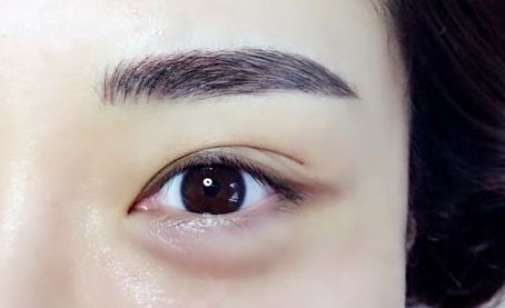 銀川有哪些專業(yè)的激光祛痘印醫(yī)院值得推薦？