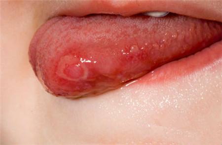 2023信陽精雕瘦腰部專家排行前十位(正冬學(xué)、李孝輝、周平價(jià)格實(shí)惠公道)