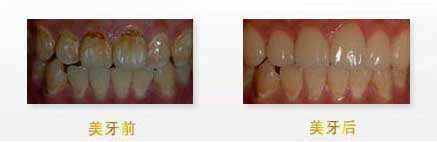 揭秘：武漢眼科醫(yī)生，他們的技術(shù)無(wú)人能敵！