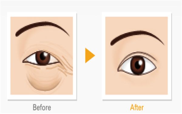 哈爾濱隆胸修復(fù)醫(yī)院排名及口碑對比，哪家專業(yè)又靠譜？