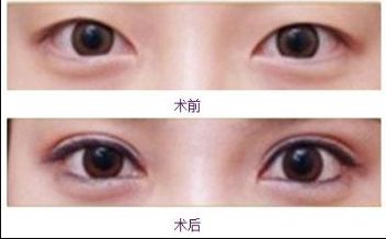 合肥美白針哪家醫(yī)院好？排名前幾位的合肥專業(yè)美膚診所推薦