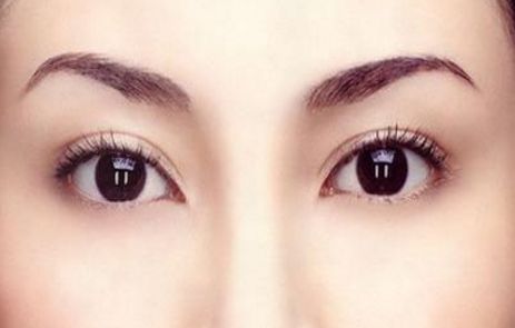 中國哪家假體隆胸醫(yī)院好？2023排名TOP10及專家推薦