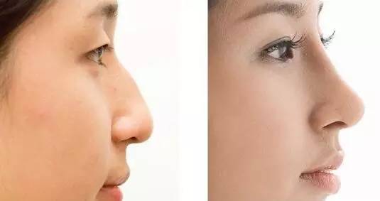 2023沈陽物理祛除法令紋推薦前十強(qiáng)專家(魏思剛、李麗欣、譚佳男反饋看挺靠譜)