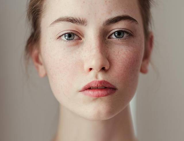 武漢嚴(yán)玲玲做雙眼皮效果如何？專家?guī)私馐中g(shù)技術(shù)和價格