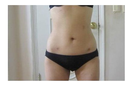 南寧市整容醫(yī)院排名，哪家整容醫(yī)院在南寧市口碑好？