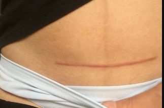 如何選擇新疆做胎記醫(yī)院，哪家好？