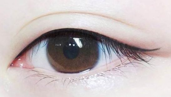 【長治哪家醫(yī)院祛痣效果好？專家推薦讓你放心選擇】