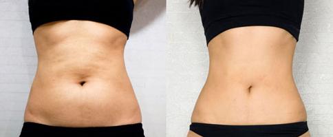 上海的隆胸醫(yī)生盤點(diǎn)！王濤、江華、何金光等出色醫(yī)師吸睛！