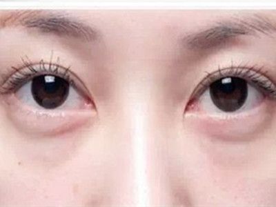 寧波祛斑哪家醫(yī)院好？精選寧波祛斑專業(yè)醫(yī)院推薦！