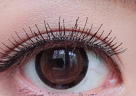 2023烏魯木齊激光祛疤痕正規(guī)專家排名10強(艾克拜爾、閆霜、張煒簡歷來了好好看)