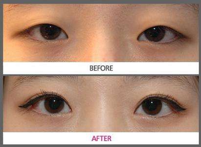 2023烏魯木齊長(zhǎng)痘點(diǎn)陣激光排名榜前十專家(王春利、吳京慶、張偉實(shí)力鎖定榜一_推薦收藏)