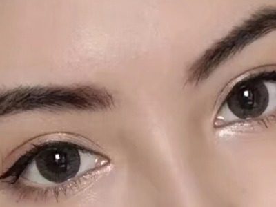 2023成都面部脂肪填充川字紋醫(yī)生排行前十位(趙術、李文明、蔣代為技術實力優(yōu)異)