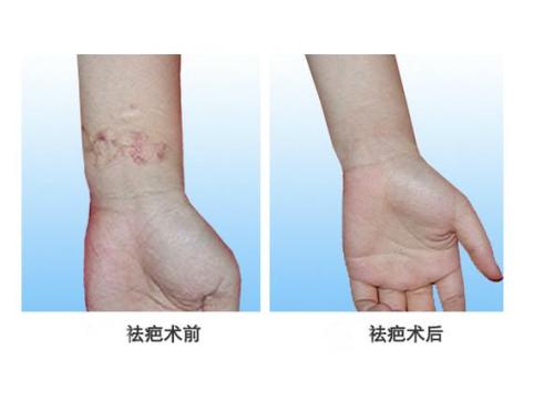 2023濟(jì)南重瞼權(quán)威專家排名榜前十位(周興亮、白華寶、蘇雪蓮技術(shù)強(qiáng)、口碑好)