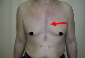 福州果酸換膚哪家醫(yī)院好？