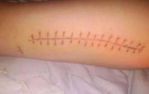 水光針武漢三甲醫(yī)院哪家好？如何選擇適合自己的水光針服務(wù)醫(yī)院