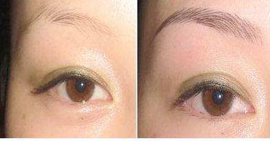 湖北哪家醫(yī)院治療團結口好呢？