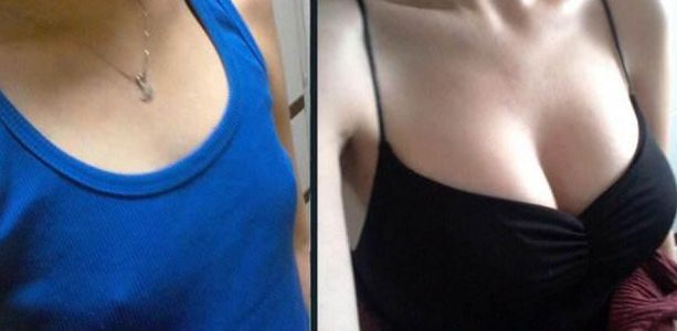 福州鼻梁手術(shù)哪家醫(yī)院好？淺析福州頂級(jí)整形醫(yī)院鼻部整形技術(shù)