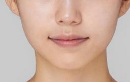 2023承德微雕祛除額頭紋上榜清單前十名醫(yī)生(于學勇、王銘、孫喜平行業(yè)強中強！)