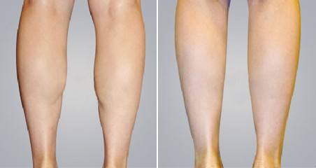 2023太原膨體膨體隆鼻正規(guī)專家推薦前十名(金勇圭、劉金超、楊俊斐勇爭前列！)