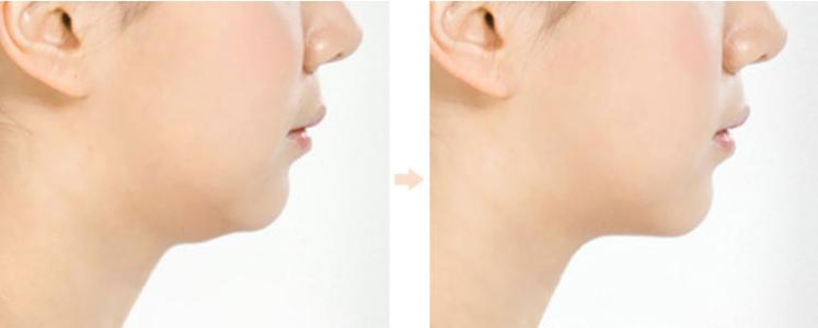 2023天津斑道夫激光祛斑權(quán)威專家榜單前十位(姚慶君、劉仕龍、曾芳等具有高人氣)