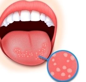 2023蘇州做大腿抽脂排行前十強(qiáng)醫(yī)生(宋艷江、童列健、孫培靈前十詳細(xì)點(diǎn)評(píng))