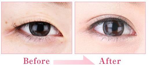 2023杭州小切口祛除眼底紋正規(guī)專家排名榜(馬康、雷小燕、盧建實(shí)力介紹全在這)