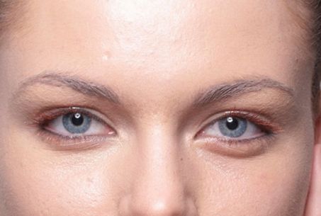 成都有哪些專業(yè)的祛斑祛痘印機構值得推薦？