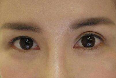 2023杭州自體脂肪豐眉弓正規(guī)專家口碑TOP10強(張常、程磊、黃臺曼口碑擅長、價格簡介盤點)