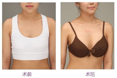 2023中山微電波拉皮除皺專家TOP10(胡可斌、肖鵬飛、鄭秋菊出名靠譜！)